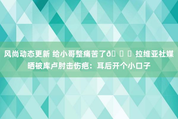 风尚动态更新 给小哥整痛苦了😅拉维亚社媒晒被库卢肘击伤疤：耳后开个小口子